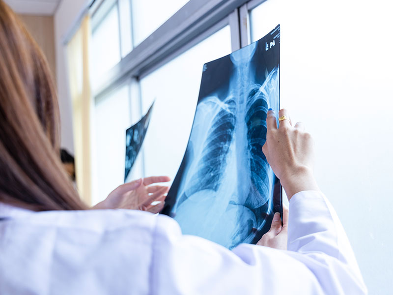 AGFA HealthCare e Konimagem apresentam inovações na Gestão de Imagens Radiológicas na JPR 2024