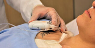 São Cristóvão Saúde adota tecnologia de curativo por pressão negativa