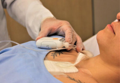 São Cristóvão Saúde adota tecnologia de curativo por pressão negativa