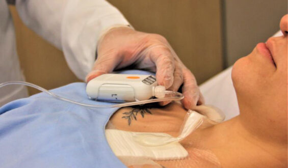 São Cristóvão Saúde adota tecnologia de curativo por pressão negativa